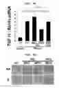 Fig. 17 - Polyion complex of double-stranded ribonucleic acid