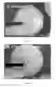 Fig. 03 - SURFACE ENGINEERING OF TISSUE GRAFT MATERIALS FOR ENHANCED POROSITY AND CELL ADHESION