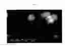 Fig. 02 - Porous particles loaded with cosmetically or pharmaceutically active compounds