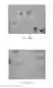 Fig. 05 - MEDICAL INSTRUMENT AND METHOD OF MANUFACTURING THE SAME