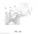 Fig. 08 - MEDICAL INSTRUMENT AND METHOD OF MANUFACTURING THE SAME