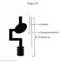 Fig. 14 - Materials and methods for the treatment of celiac disease