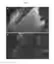 Fig. 04 - Bone substitute and method for the preparation thereof
