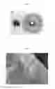 Fig. 05 - Bone substitute and method for the preparation thereof