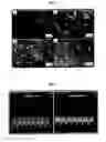 Fig. 03 - Compositions and methods for the prevention and treatment of brain diseases and conditions