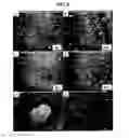 Fig. 06 - Compositions and methods for the prevention and treatment of brain diseases and conditions
