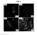 Fig. 07 - Compositions and methods for the prevention and treatment of brain diseases and conditions
