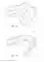 Fig. 09 - Dental apparatus and method for dentures