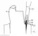 Fig. 01 - Dental retraction composition, method of production and use thereof