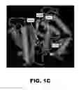 Fig. 04 - Compositions and methods for detecting cancer metastasis