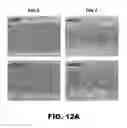 Fig. 22 - Compositions and methods for detecting cancer metastasis