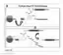 Fig. 22 - Global Proteomic screening of random bead arrays using mass spectrometry imaging
