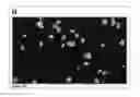 Fig. 28 - Global Proteomic screening of random bead arrays using mass spectrometry imaging