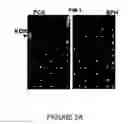 Fig. 03 - METHODS AND KITS FOR DETECTING PROSTATE CANCER BIOMARKERS