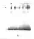 Fig. 02 - C-substituted diindolylmethane compositions and methods for the treatment of multiple cancers