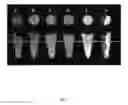 Fig. 02 - Multimodal imaging of fibrin