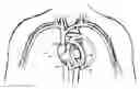 Fig. 01 - Control of circulatory assist systems
