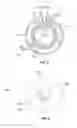 Fig. 05 - Treating heart tissue