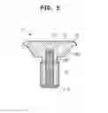Fig. 06 - COVER FOR A BONE FIXTURE