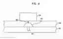 Fig. 09 - COVER FOR A BONE FIXTURE