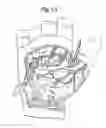 Fig. 02 - VESSEL HARVESTER