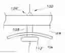 Fig. 01 - Dilation Device for Placing Catheter Tubes