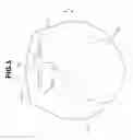 Fig. 06 - Endoscope