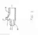 Fig. 06 - Laser video endoscope
