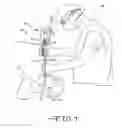 Fig. 02 - Endotracheal intubation device
