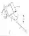 Fig. 24 - Endotracheal intubation device