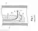 Fig. 02 - GUIDE WIRE FOR ENDOSCOPE