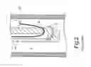Fig. 03 - GUIDE WIRE FOR ENDOSCOPE