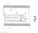 Fig. 09 - GUIDE WIRE FOR ENDOSCOPE