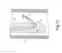 Fig. 12 - GUIDE WIRE FOR ENDOSCOPE