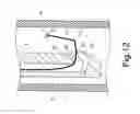 Fig. 13 - GUIDE WIRE FOR ENDOSCOPE