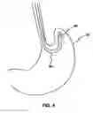 Fig. 04 - Medical device light source