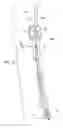 Fig. 03 - Laryngoscope and Method of Use