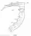 Fig. 13 - Laryngoscope and Method of Use