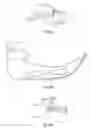 Fig. 42 - Laryngoscope and Method of Use