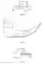 Fig. 44 - Laryngoscope and Method of Use