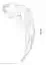 Fig. 49 - Laryngoscope and Method of Use
