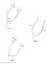Fig. 02 - Apparatus and method for intra-abdominally moving a first internal organ to a position away from a second internal organ and then holding the first internal organ in the position without manual input