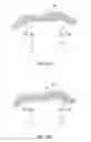 Fig. 16 - Apparatus and method for intra-abdominally moving a first internal organ to a position away from a second internal organ and then holding the first internal organ in the position without manual input