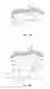 Fig. 18 - Apparatus and method for intra-abdominally moving a first internal organ to a position away from a second internal organ and then holding the first internal organ in the position without manual input