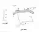 Fig. 19 - Apparatus and method for intra-abdominally moving a first internal organ to a position away from a second internal organ and then holding the first internal organ in the position without manual input