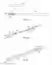 Fig. 34 - Apparatus and method for intra-abdominally moving a first internal organ to a position away from a second internal organ and then holding the first internal organ in the position without manual input