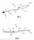 Fig. 02 - MINIMALLY INVASIVE SUCTION RETRACTOR