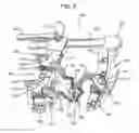Fig. 05 - Method and Devices for Improved Tissue Stabilization