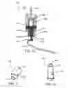 Fig. 10 - Method and Devices for Improved Tissue Stabilization