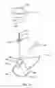 Fig. 12 - Method and Devices for Improved Tissue Stabilization